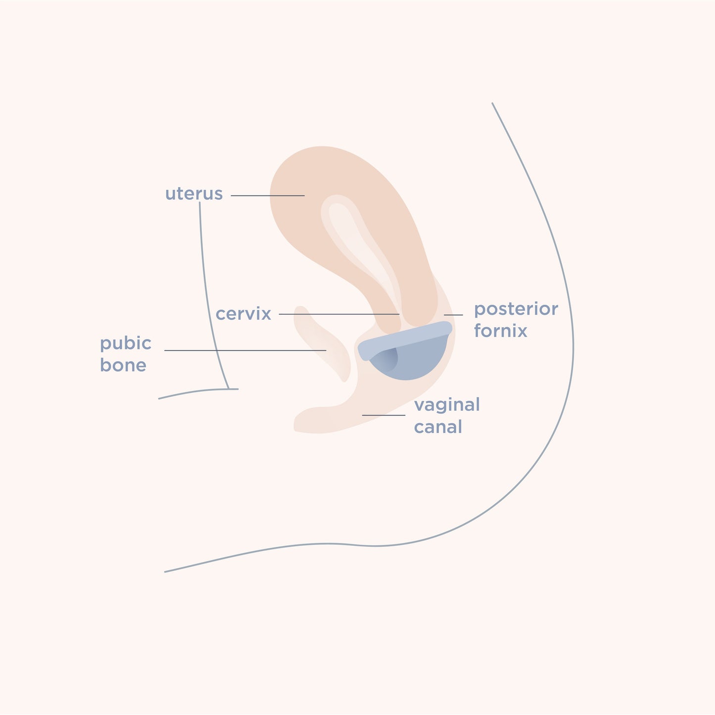 menstrual disc